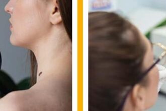 Rastreio do cancro - Foto-Reprodução_Município de Monchique